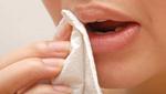 Mắc bệnh viêm da do sử dụng giấy vệ sinh thay giấy ăn 